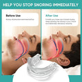Anti-Snoring Mouthpiece – Comfortable Sleep Support Device